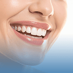 Czy można wziąć pożyczkę na wybielanie zębów? Ile to kosztuje?