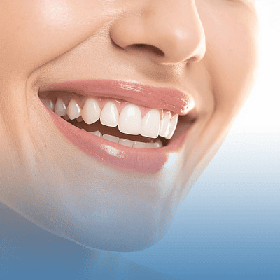 Czy można wziąć pożyczkę na wybielanie zębów? Ile to kosztuje?